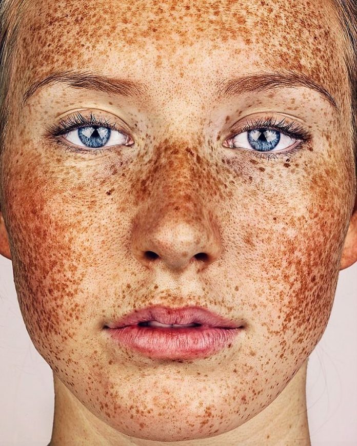 The Beauty of Freckles by Brock Elbank | Art Ctrl Del