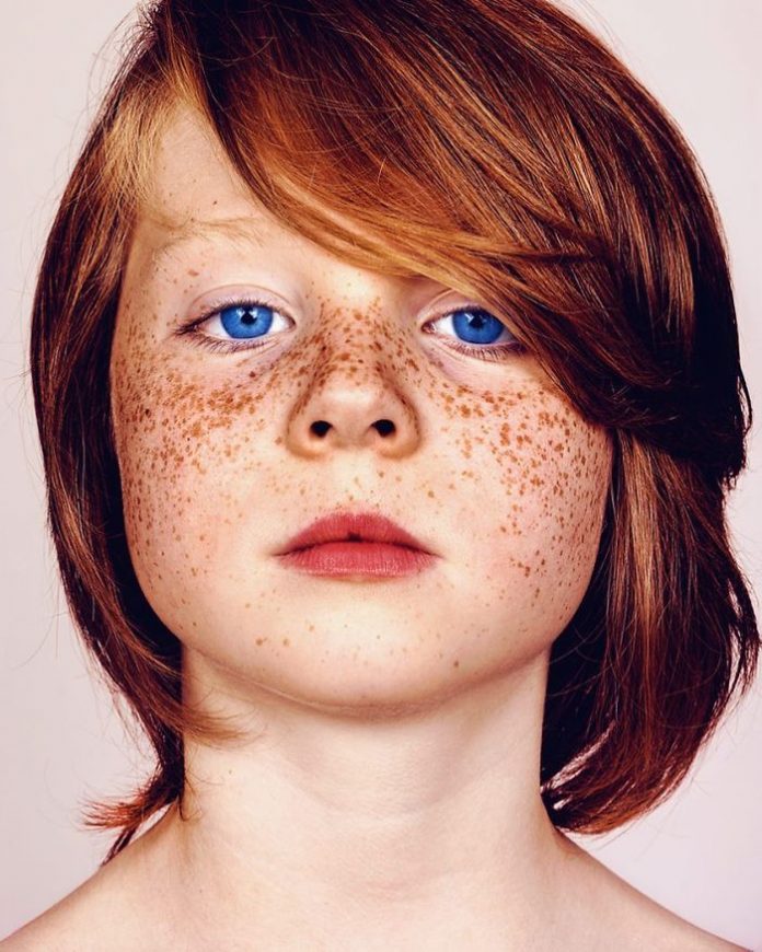 The Beauty Of Freckles By Brock Elbank Art Ctrl Del