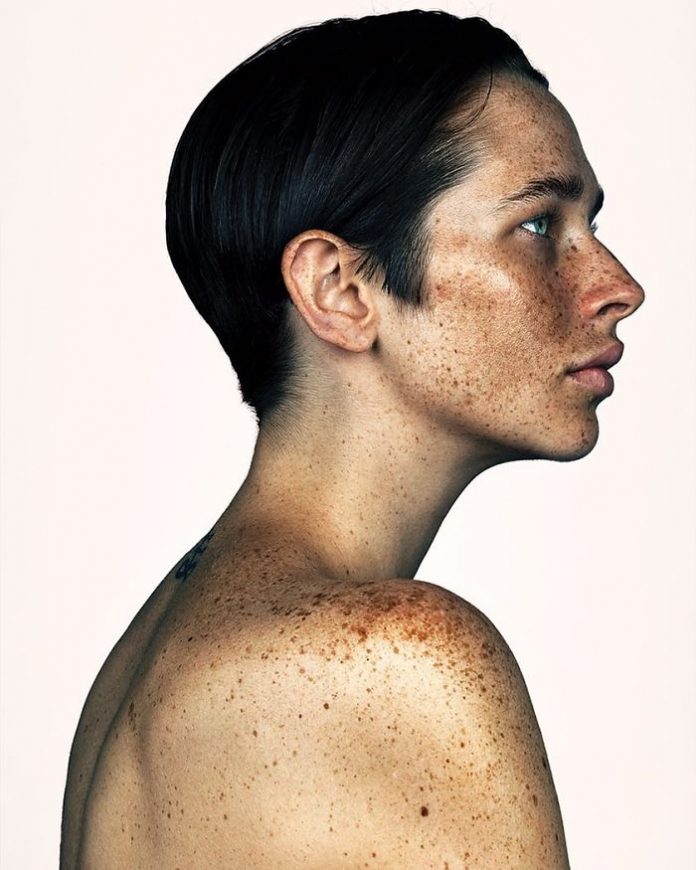 Brock Elbank The Beauty Of Freckles By Brock Elbank Art Ctrl Del 4243